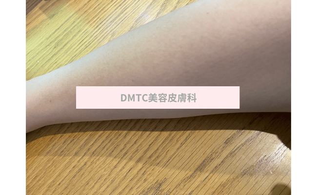 DMTC3