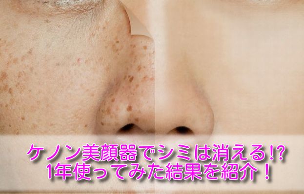 顔 の シミ を 取る 方法